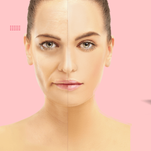 [PROMO] Evolysse (1ml)