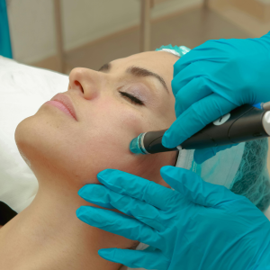 [PACKAGE] Microneedling, Dermal Infusion Facial, Custom Facial, Lip Flip Treatment